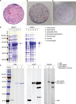 Frontiers | Serum Anti-BRAT1 is a Common Molecular Biomarker for 